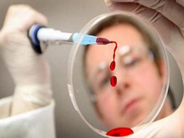 Aids novos casos foram registrados em 2013 em Teixeira (2)