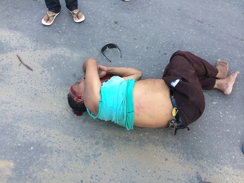 Homem e atropelado por motocicleta no centro de Teixeira de Freitas