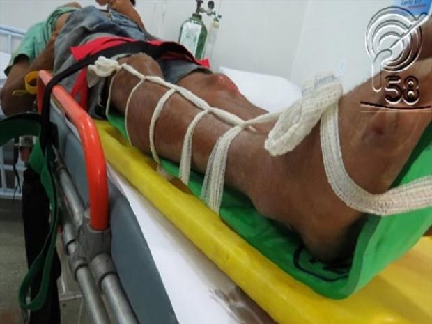 Motorista desconhecido atropela morador de rua e foge (2)