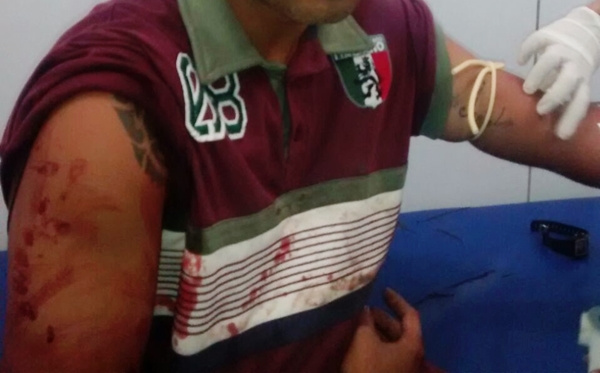 Alison Alves dos Santos baleado no Joao Mendonca