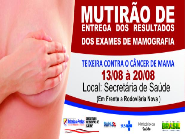 ENTREGA EXAMES MAMOGRAFIA (1)