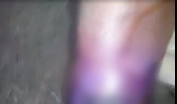 Imagens fortes! Idoso era devorado vivo por larvas (1)