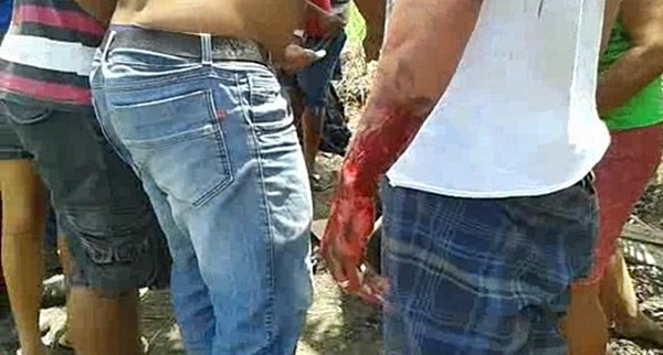 BR-101 quatro pessoas ficam feridas em acidente grave (4)