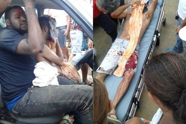 Caminhao bate em Carro feridos