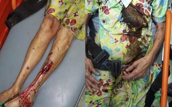 Mae agredida por Jose Carlos de Jesus de Souza