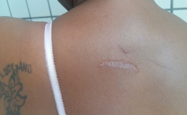 Mulher agredida por Gerson Silva dos Santos2