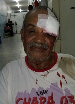 Almedino Rosa de Oliveira