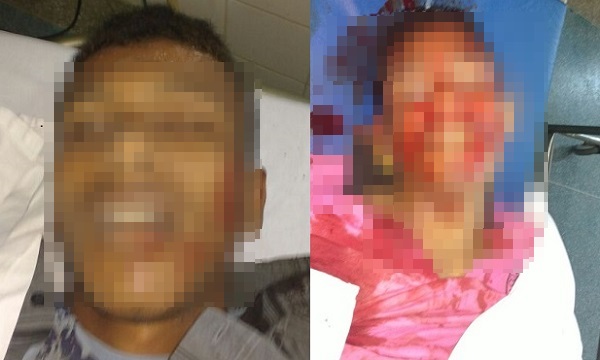 dupla-com-submetralhadora-troca-tiros-com-o-ceto-de-porto-seguro-e-morrem-no-confronto